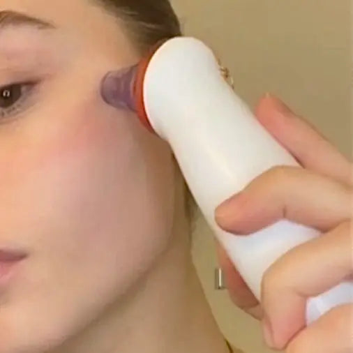 Wholesale Microdermabrasion Skin Rejuvenation Kit